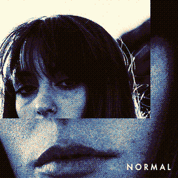 Normal